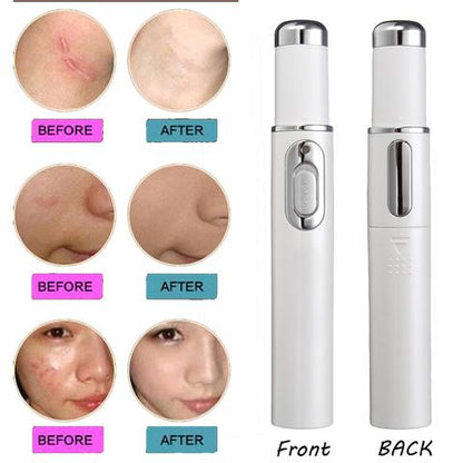 Blue Light Therapy Acne Laser Pen Soft Scar Wrinkle Removal Treatment