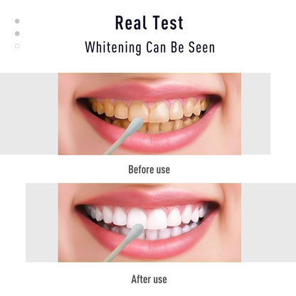 Teeth Whitening Pen Tooth Gel White  Kit Cleaning Bleaching Remove