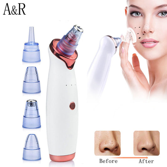 Blackhead Remover Vacuum Electric